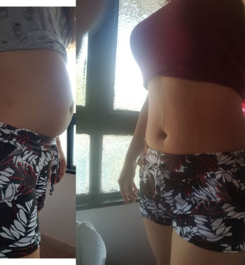Faja de Yeso - Lipoyesoterapia + Regalo