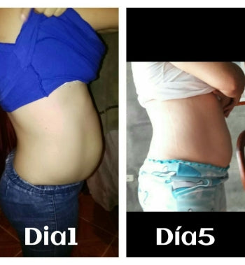 Faja de Yeso - Lipoyesoterapia + Regalo