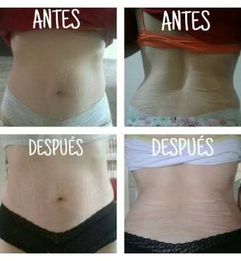 Faja de Yeso - Lipoyesoterapia + Regalo